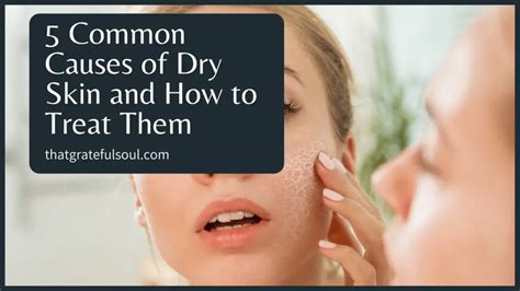 5 Common Causes of Dry Skin and How to Treat Them