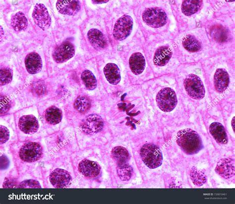 Mitosis In Onion Cells Of The Root Meristem. In The Center A Typical Metaphase Can Be Seen, With ...