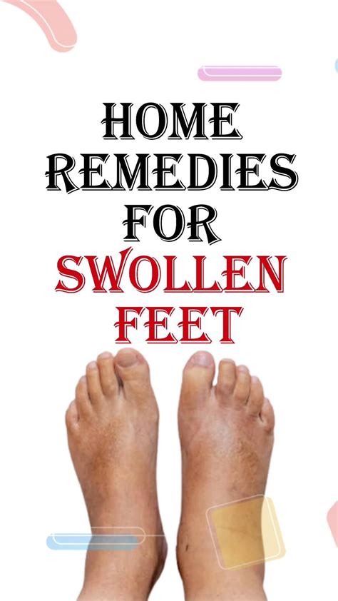 Effective home remedies for swollen feet – Artofit