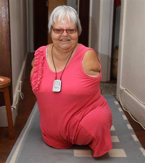 Monica Gerhard was born without legs and arms, but still lives a full life