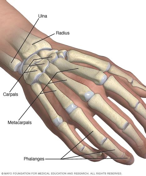 Broken wrist/broken hand - Symptoms and causes - Mayo Clinic