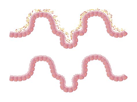 The Function of Villi in the Small Intestine – Perkins School for the Blind