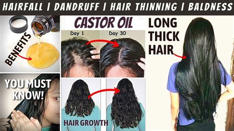 CASTOR OIL Benefits For HAIR in Hindi | Best Castor Oil for HAIR GROWTH | Stop HAIRFALL ...