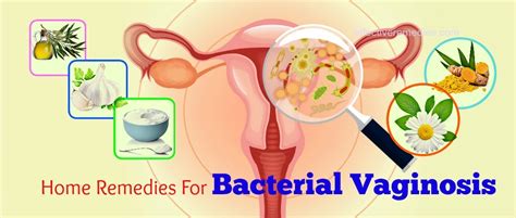 20 Effective Home Remedies For Bacterial Vaginosis - 100% Natural