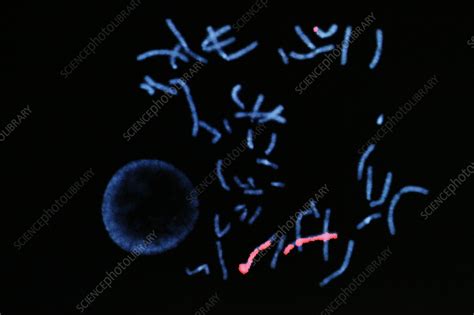 Karyotype analysis - Stock Image - C058/6163 - Science Photo Library