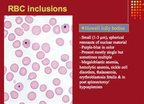 Howell Jolly Bodies | Medical Laboratories