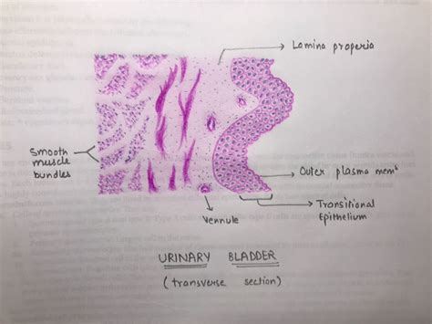 Urinary bladder | Bladder, Histology slides, Pathology