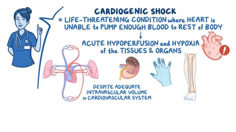 Shock Signs Symptoms And Complications