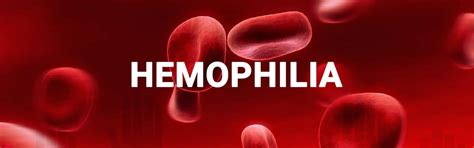 Hemophilia - Causes, Signs, Symptoms, Types, Inheritance, Treatment