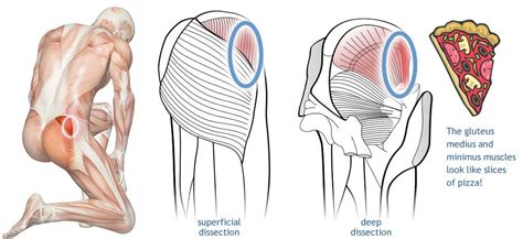 Anatomical diagram showing gluteus minimus and gluteus medius, and their similarity in shape to ...