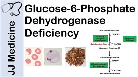 Glucose 6 Phosphate