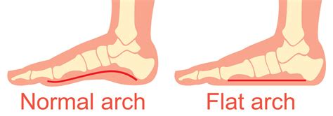 The Arches Of The Foot Longitudinal Transverse TeachMeAnatomy | 6b.u5ch.com