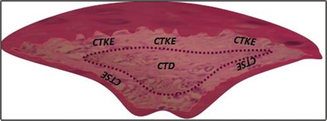 Histological section of a papilla with the schematic representation of... | Download Scientific ...