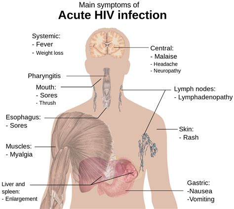 Human Immunodeficiency Virus Symptoms