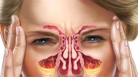 Nasal Sinuses Anatomy | Faculty of Medicine