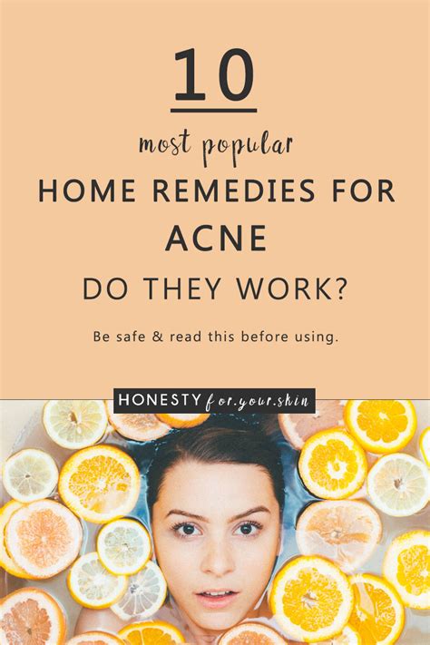 home-remedies-for-acne - Honesty For Your Skin