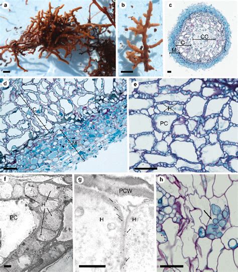 Evidence for ectomycorrhizae (ECM) in roots of Prunus serotina. (a–b ...