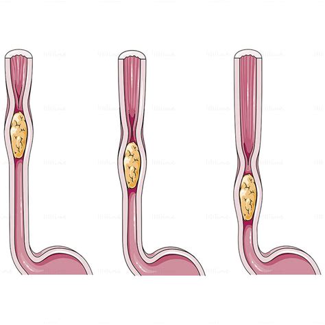 Peristalsis of the intestines vector | Biology facts, Science experiments kids, Body anatomy