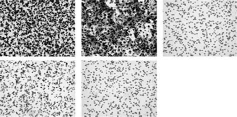 Cell migration (A) and statistical analysis (B) of cell migration in... | Download Scientific ...