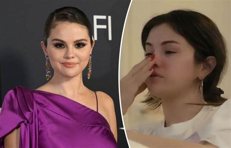 What Is lupus? Selena Gomez breaks down over her Diseases in her new ...