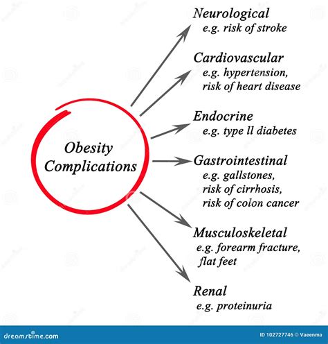 Complications of obesity stock illustration. Illustration of renal ...