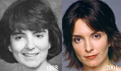 Tina Fey Plastic Surgery - Tina Fey Scar Before and After Photos ...