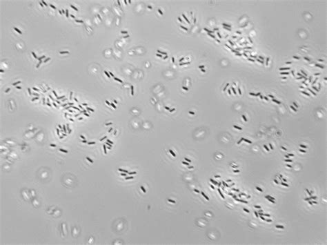 Lactobacillus Staining