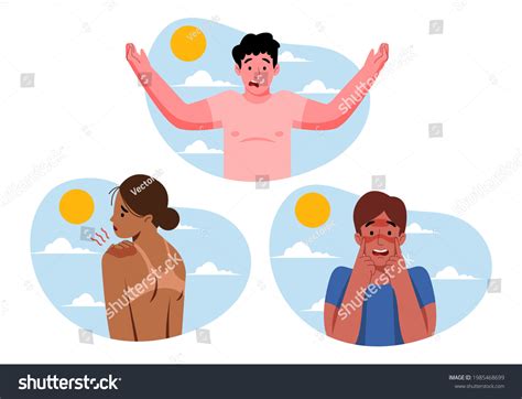 13,602 Sunburn Stock Illustrations, Images & Vectors | Shutterstock