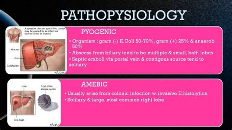 Abscess of liver