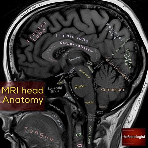 Sagittal View Of Brain Mri