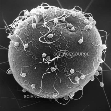 Fertilization of Sea Urchin Egg, SEM | Stock Image - Science Source Images