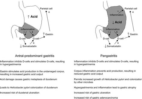 The effect of gastritis pattern on gastric acid production and ...