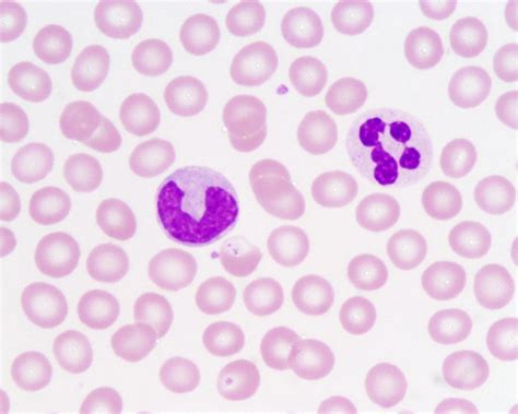 Neutrophil and monocyte - human blood smear (Wright's stai… | Flickr