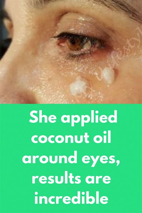 She applied coconut oil around eyes, results are incredible I have already told you beauty benef ...