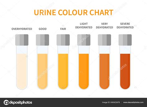 Urine Colour Chart Hydration Dehydration Level Diagram Medical Urinal ...