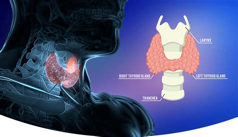 Thyroid & Parathyroid surgery by Dr. Pradeep Chowbey