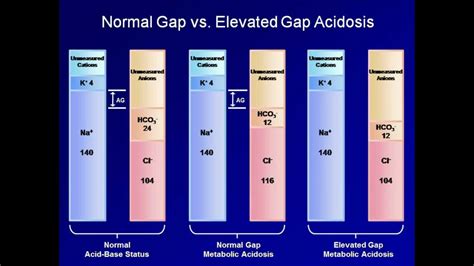 normal anion gap metabolic acidosis - Justin Miller