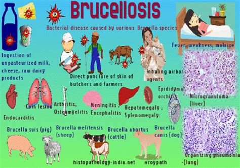 Brucellosis - WOAH Middle-East