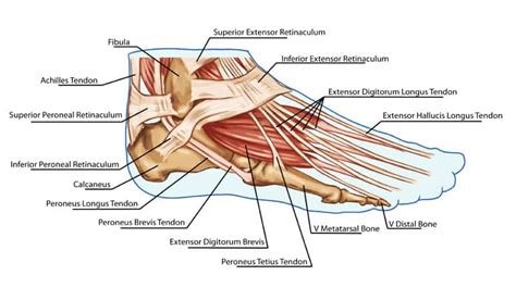 Extensor Tendonitis of the Foot: Explained by a Foot Specialist