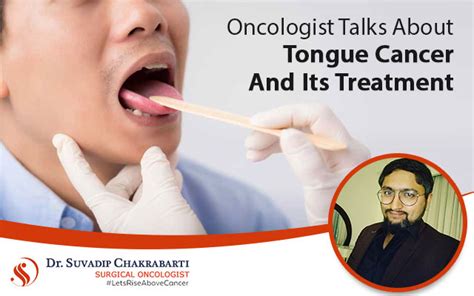 Oncologist Talks About Tongue Cancer And Its Treatment