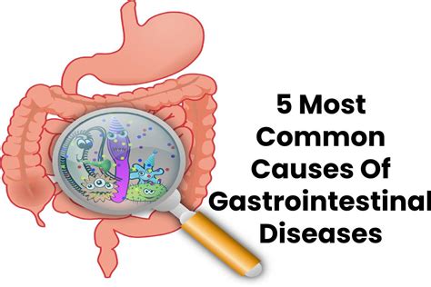 5 Most Common Causes Of Gastrointestinal Diseases-Health Bloging