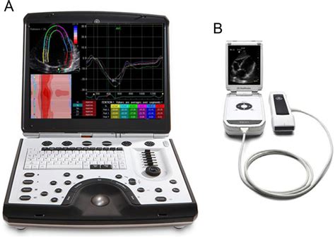 Type of handheld ultrasound machines. There are several types of ...