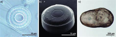 a, b) The diatom Cyclotella plitvicensis in the light (a) and electron... | Download Scientific ...