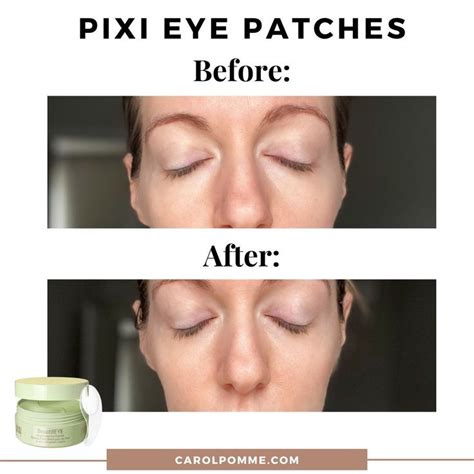 Pixi Eye Patches before and after nel 2023 | Bende per gli occhi, Pixie