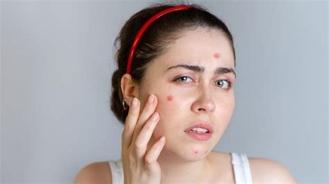 चेहरे पर मलाई लगाने के भी हो सकते हैं कुछ नुकसान, जानें इनके बारे में | side effects of malai ...