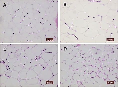 Histology of adipose tissue of mice fed the experimental diets for 15 ...