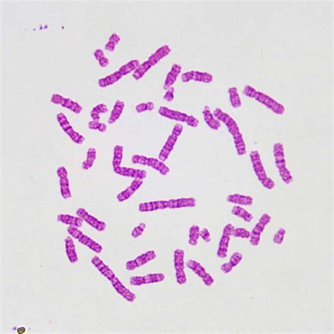 Chromosome