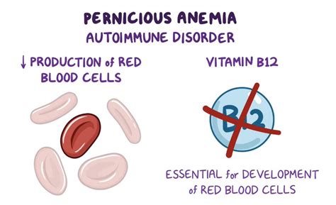 Pernicious Anemia Treatment