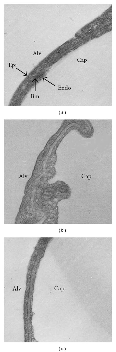 Transmission electron microscopy of the air-blood barrier in control ...