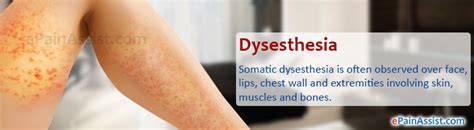 Q and A On Dysesthesia|Types-Somatic, Visceral, Cutaneous, Occlusive ...